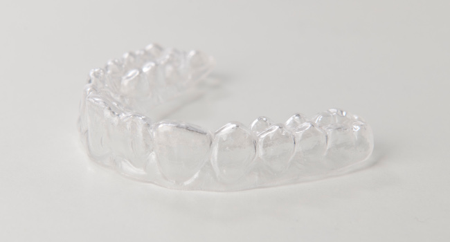Aligner, lose Zahnspange, durchsichtige Zahnspange